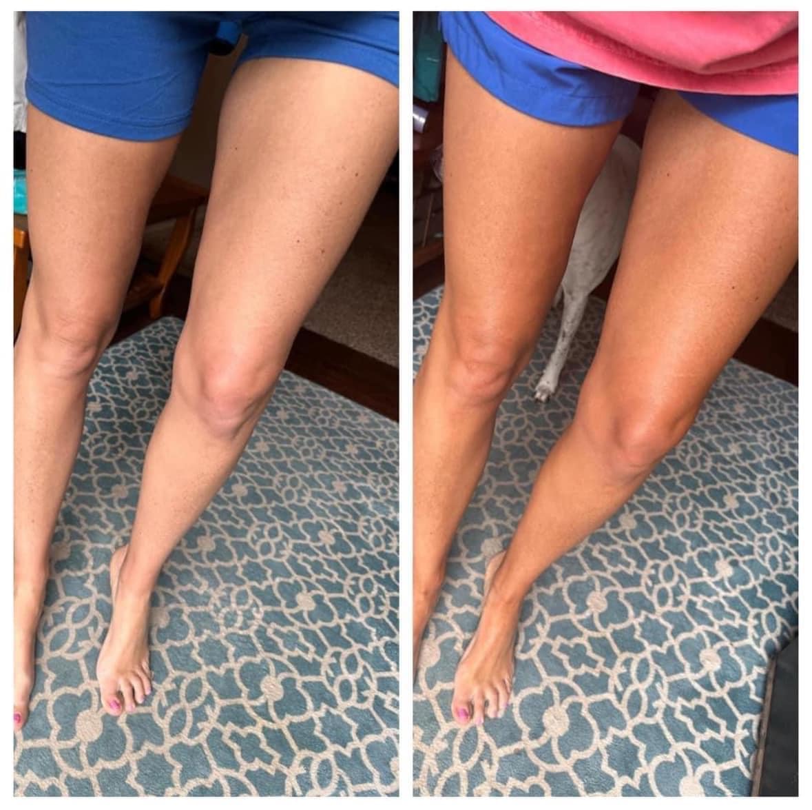 Sunless Tanner